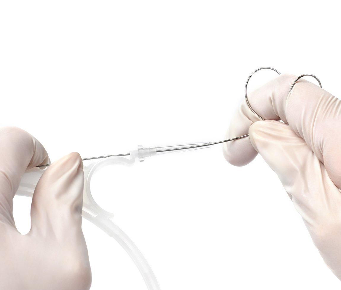Unlocking Nitinol Guide Wires' Potential in Contemporary Medicine 